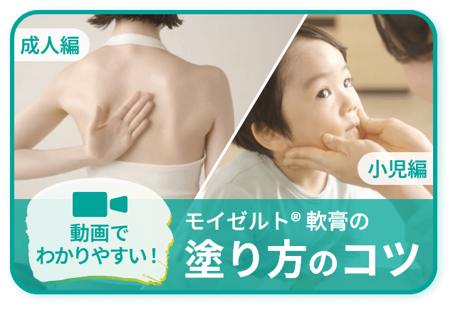 動画でわかりやすい！モイゼルト®軟膏の塗り方のコツ